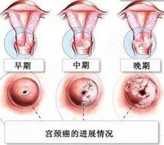 杭州市濱江區(qū)HPV宮頸癌疫苗接種點地址及預(yù)約咨詢電話